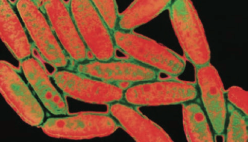 Figure 2 Legionella pneumophilla (National Health Service UK, 2012)